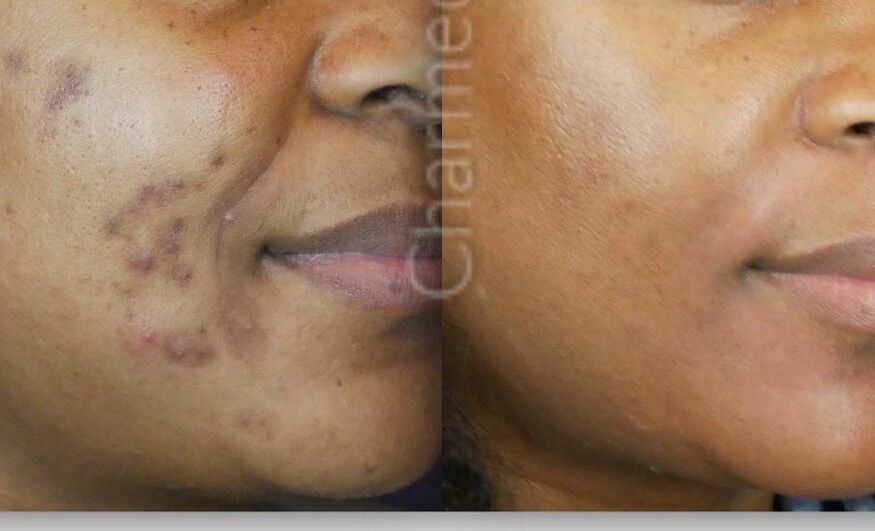 Delaware medical spa specializing in ZO Skin Health