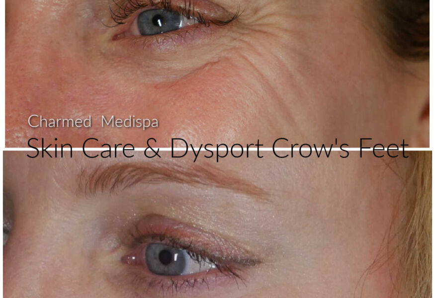 Botox Delaware Med Spa