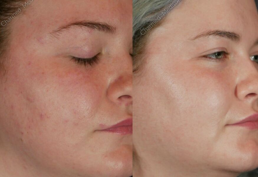 Charmed Medispa ZO Skin Health Skin Care Newark Delaware